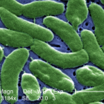 Avoid rare-but-dangerous germ: Keep out of water with open cuts, wounds