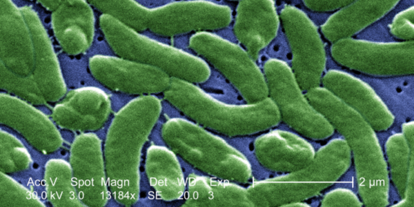 Avoid rare-but-dangerous germ: Keep out of water with open cuts, wounds